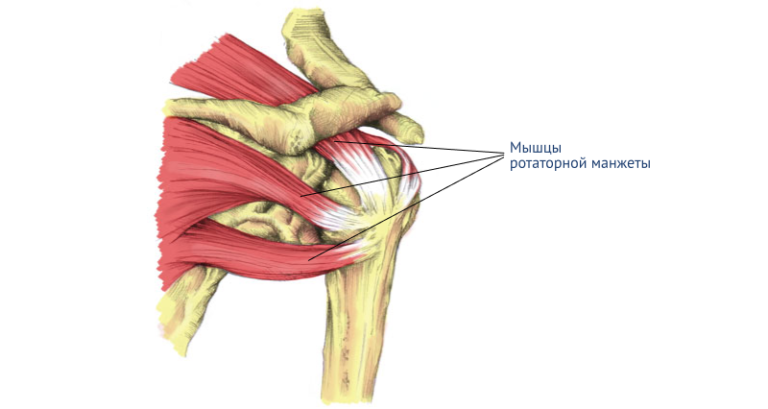 Разрыв сухожилия надостной мышцы плечевого сустава фото