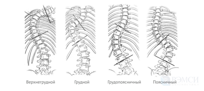 Стол правосторонний и левосторонний