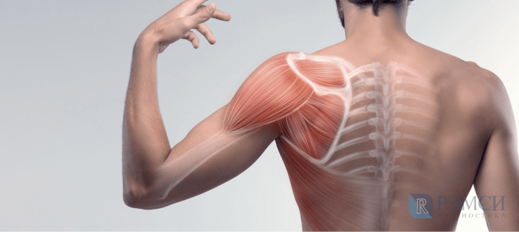 article img 1 shoulder blades pain
