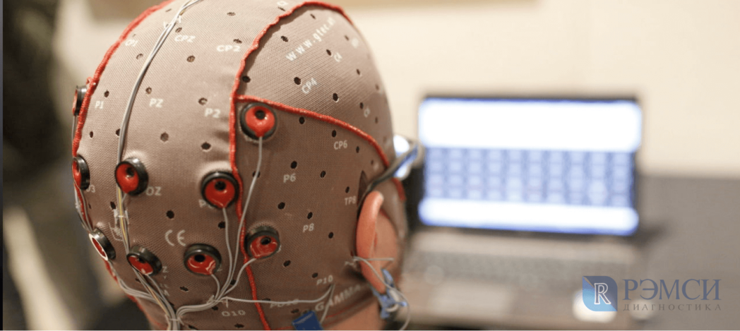 Как проходит исследование головного мозга: процедура ЭЭГ