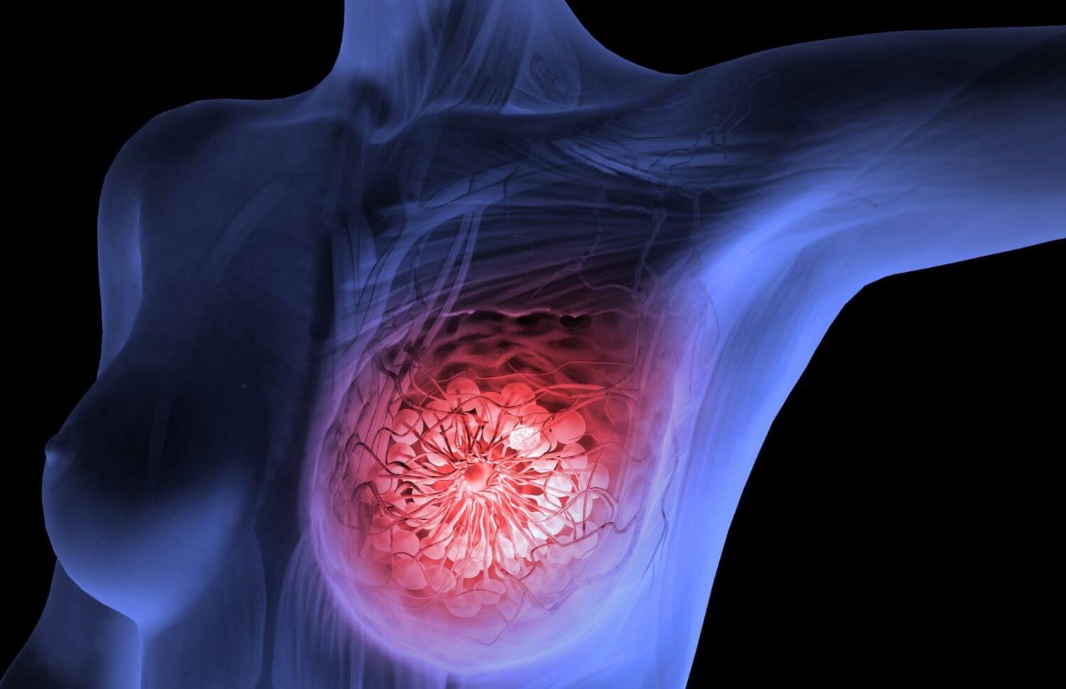 Причины появления болей в грудной клетке