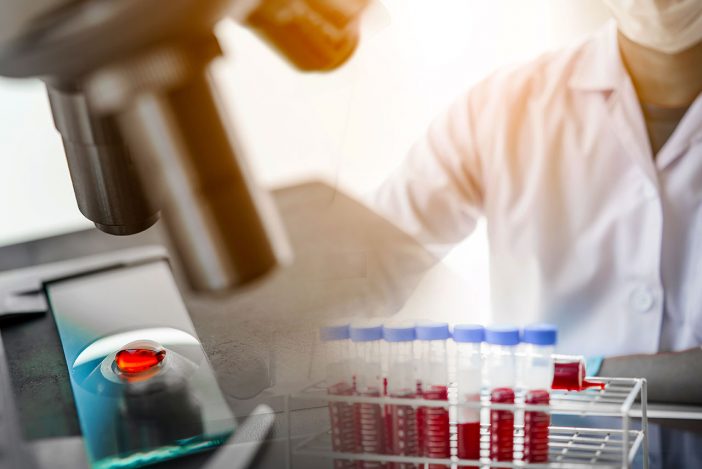 Базофилы в крови - уровень нормы у мужчин и женщин, причины пониженного ...